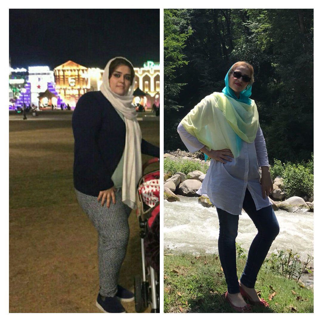 قبل و بعد از عمل