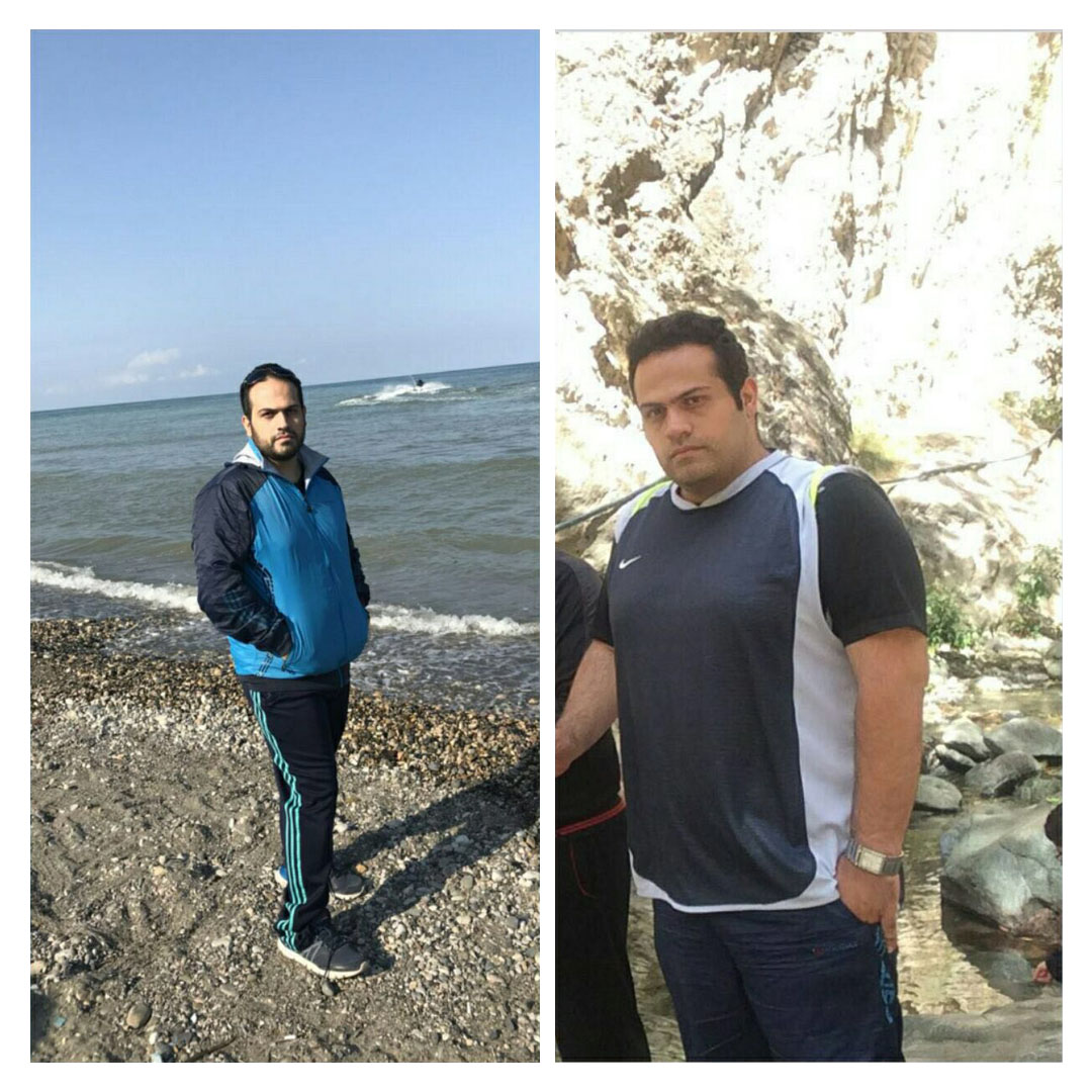 قبل و بعد از عمل