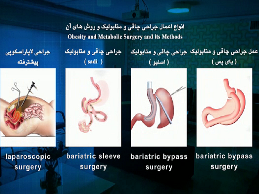 جراحی چاقی و متابولیک در کلینیک دکتر علی بیگی