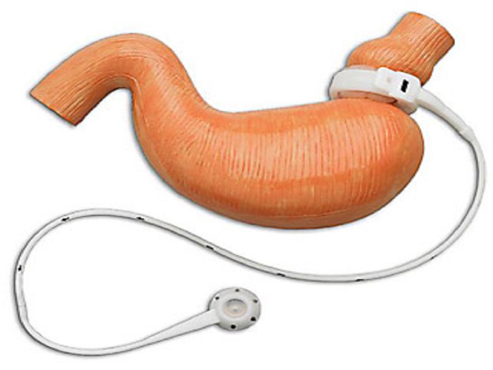 انواع جراحی چاقی